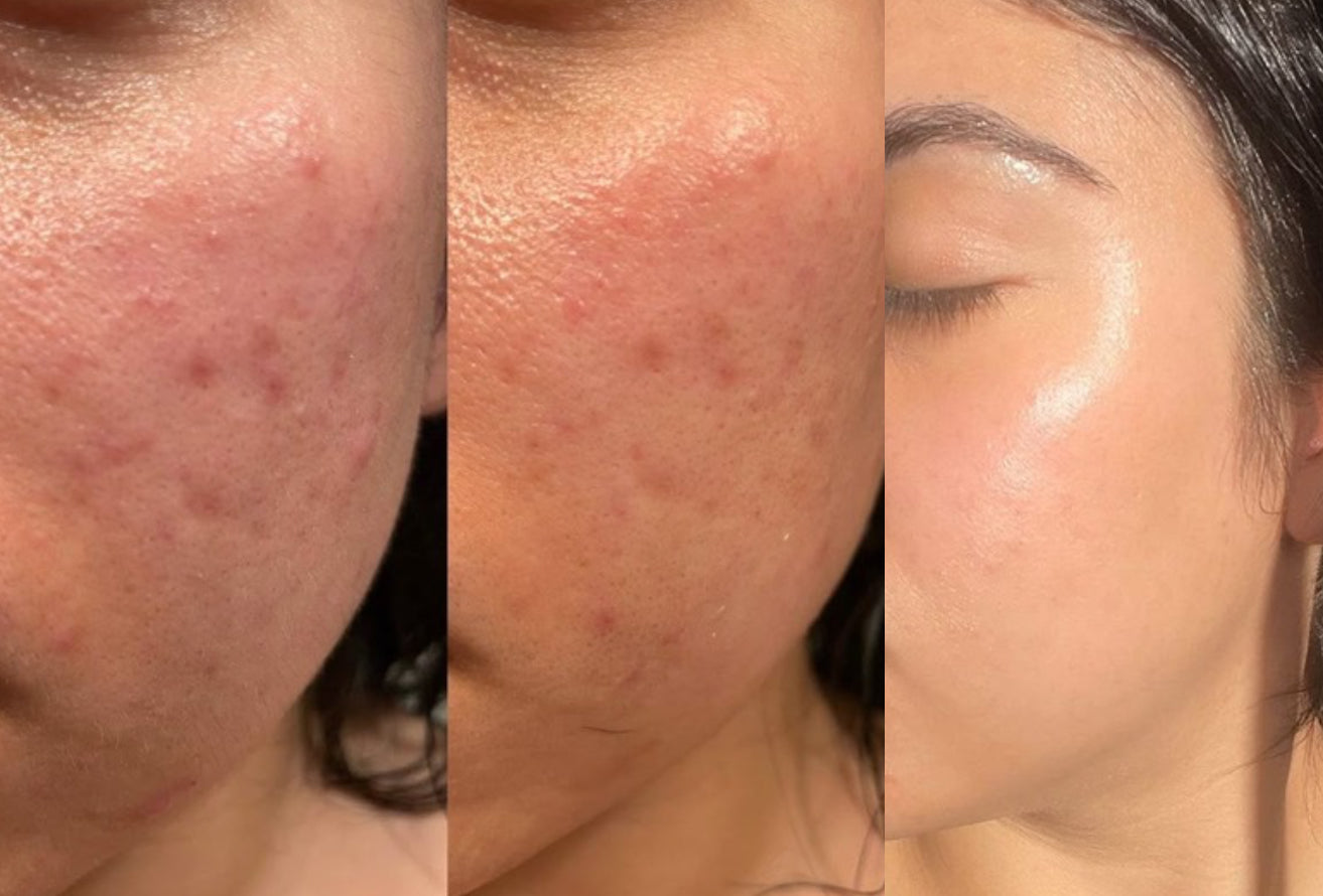 FRAISE đ - MASQUE JELLY PEAU GRASSE