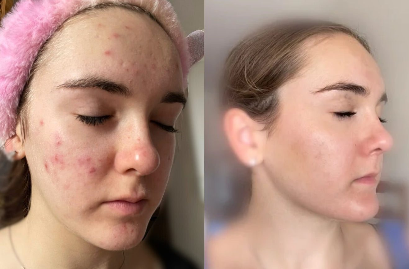 FRAISE đ - MASQUE JELLY PEAU GRASSE