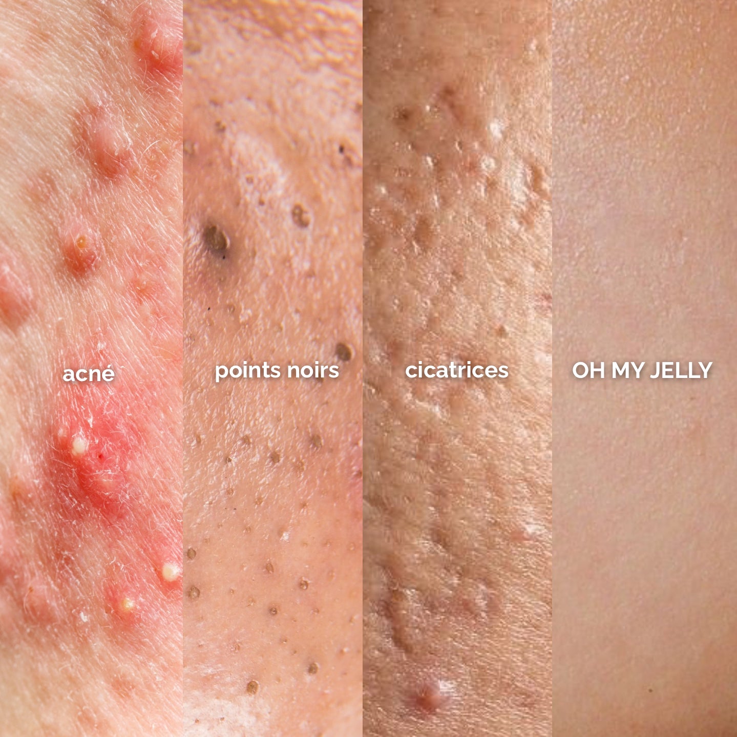 FRAISE đ - MASQUE JELLY PEAU GRASSE