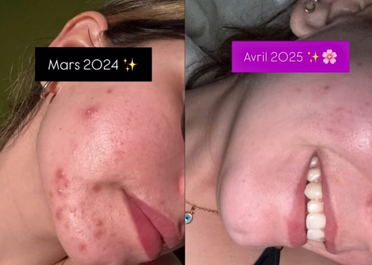 FRAISE đ - MASQUE JELLY PEAU GRASSE