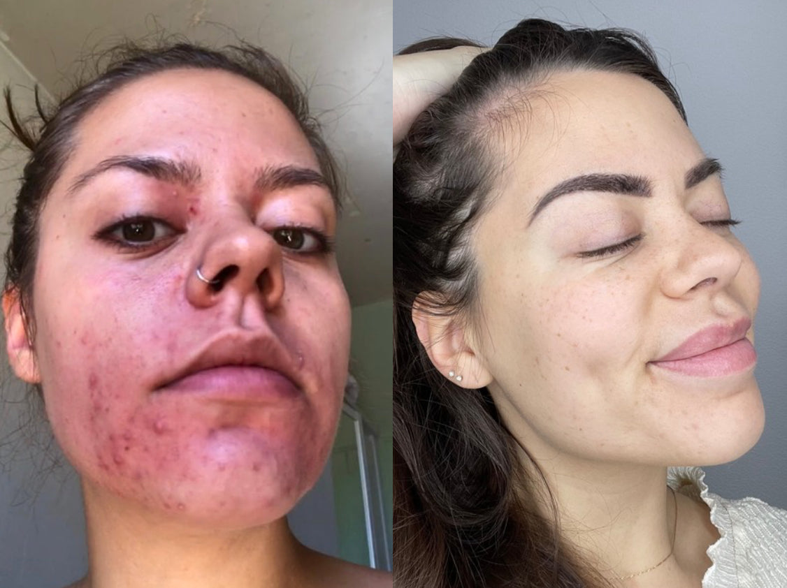 FRAISE đ - MASQUE JELLY PEAU GRASSE