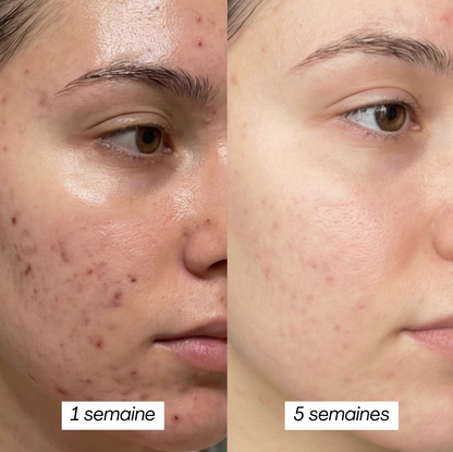 PEAU GRASSE - MASQUE JELLY