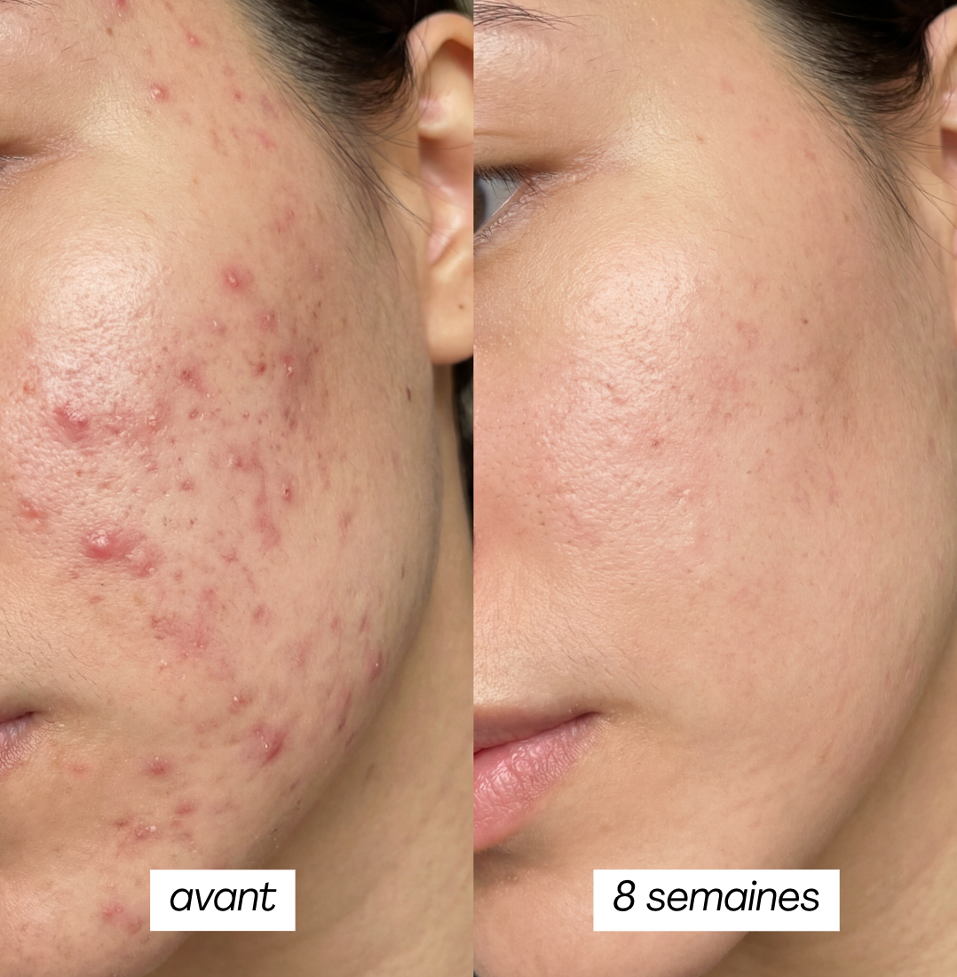 PEAU GRASSE - MASQUE JELLY