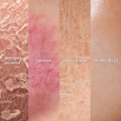 CONCOMBRE 🥒 - MASQUE JELLY PEAU SÈCHE