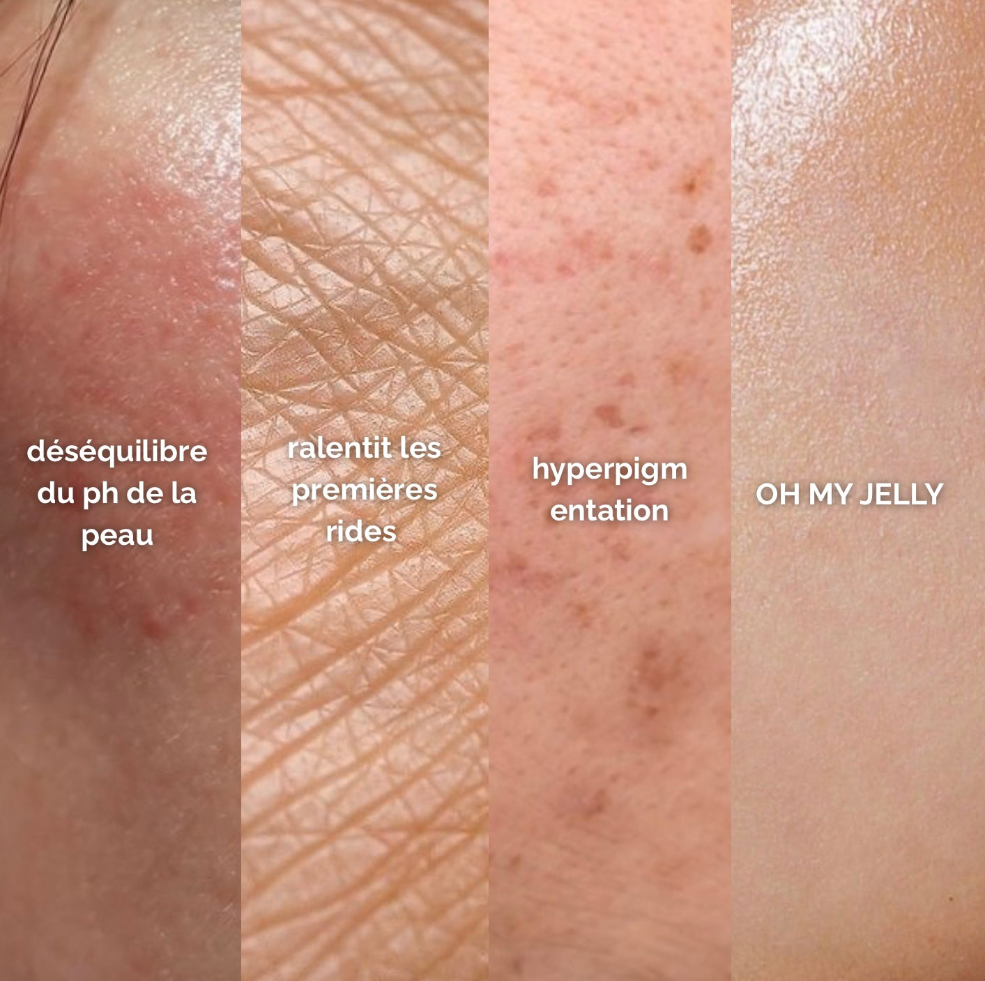 MYRTILLE 🫐 - MASQUE JELLY PEAU MIXTE