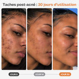 MASQUE JELLY ANTI-TACHES